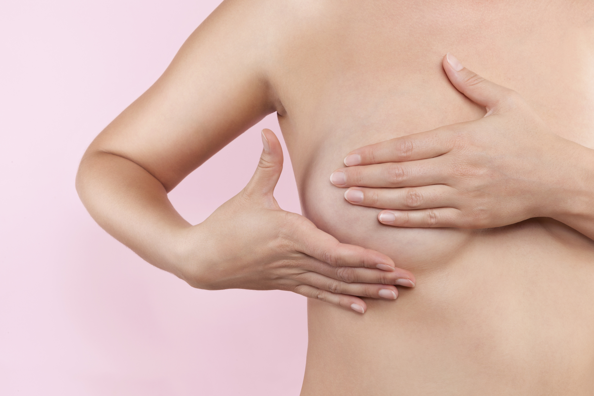 Mamoplastia redutora: cirurgia plástica para diminuir o tamanho e peso das mamas